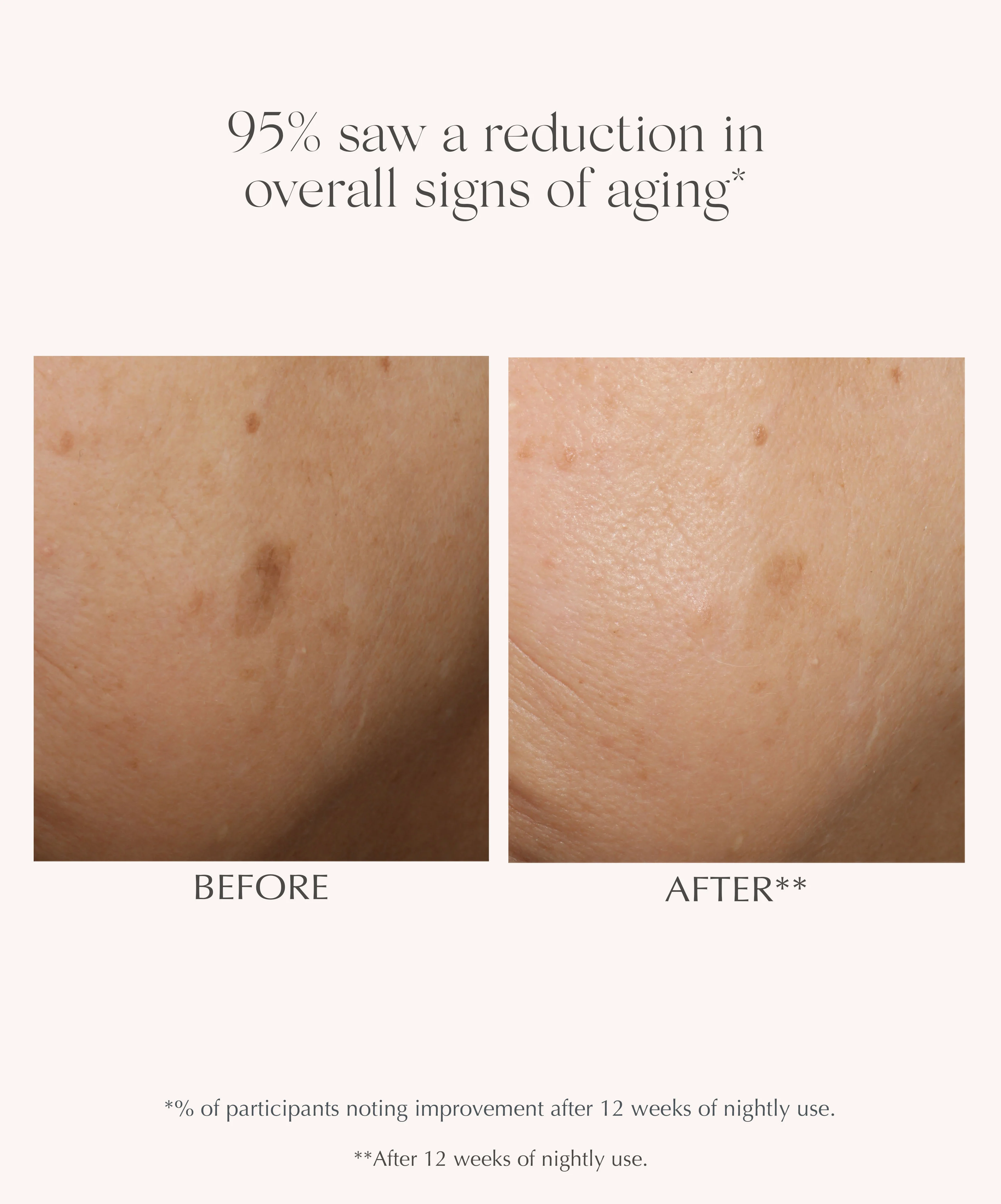 AGE REVERSE+ Advanced Renewal Retinol Serum - Image 5