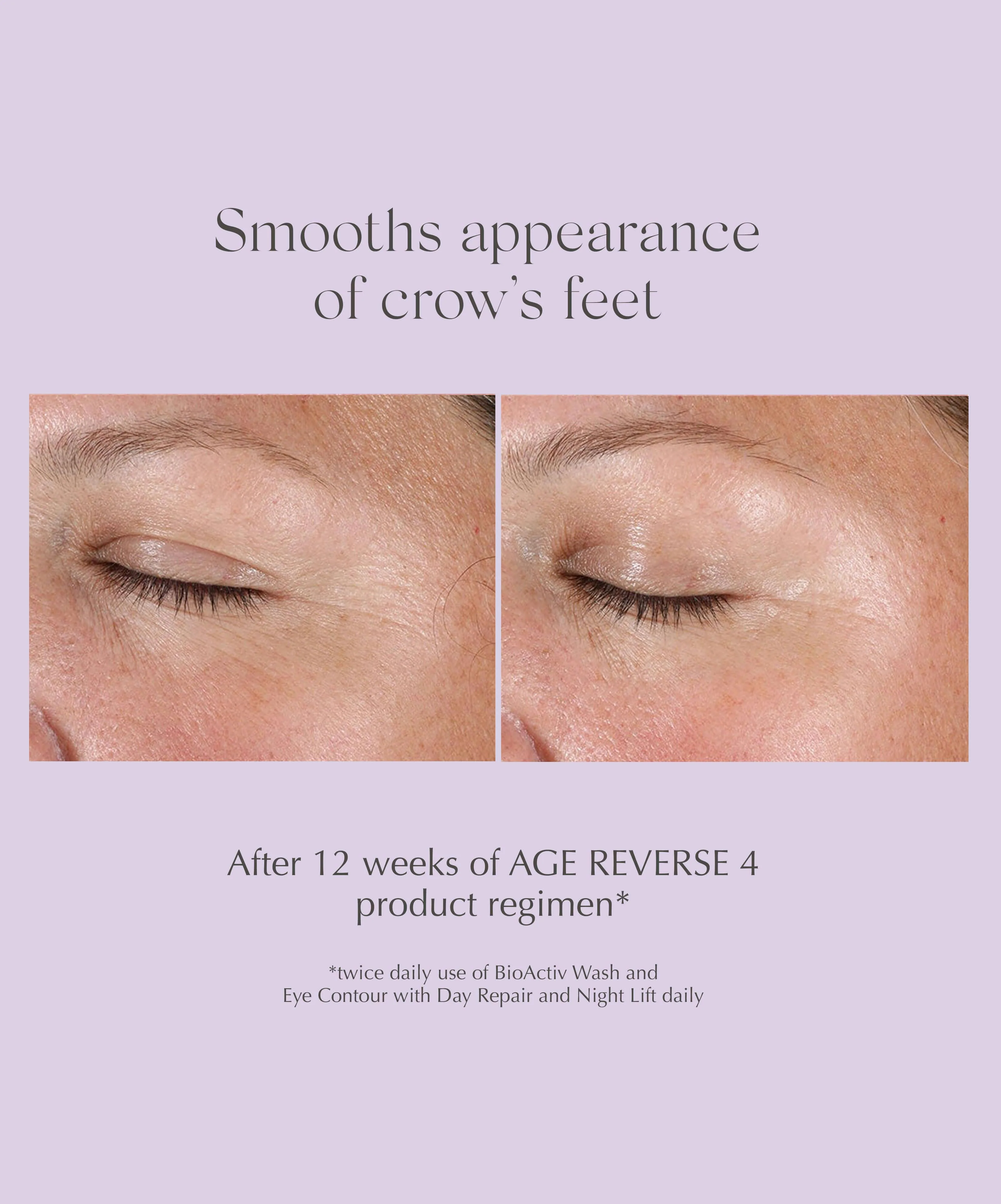 AGE REVERSE Eye Contour - Image 5