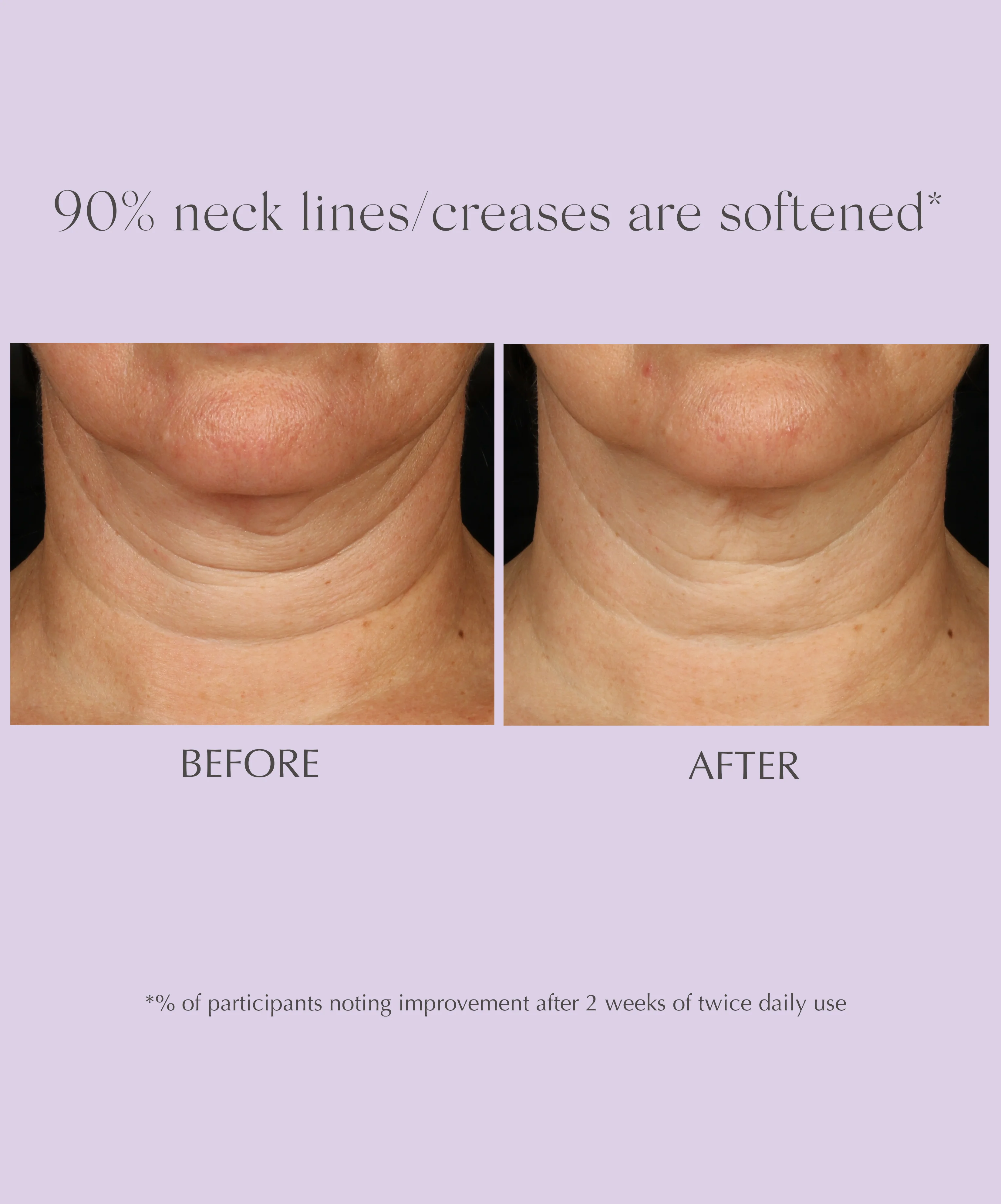 AGE REVERSE+ Toning Neck Cream - Image 8