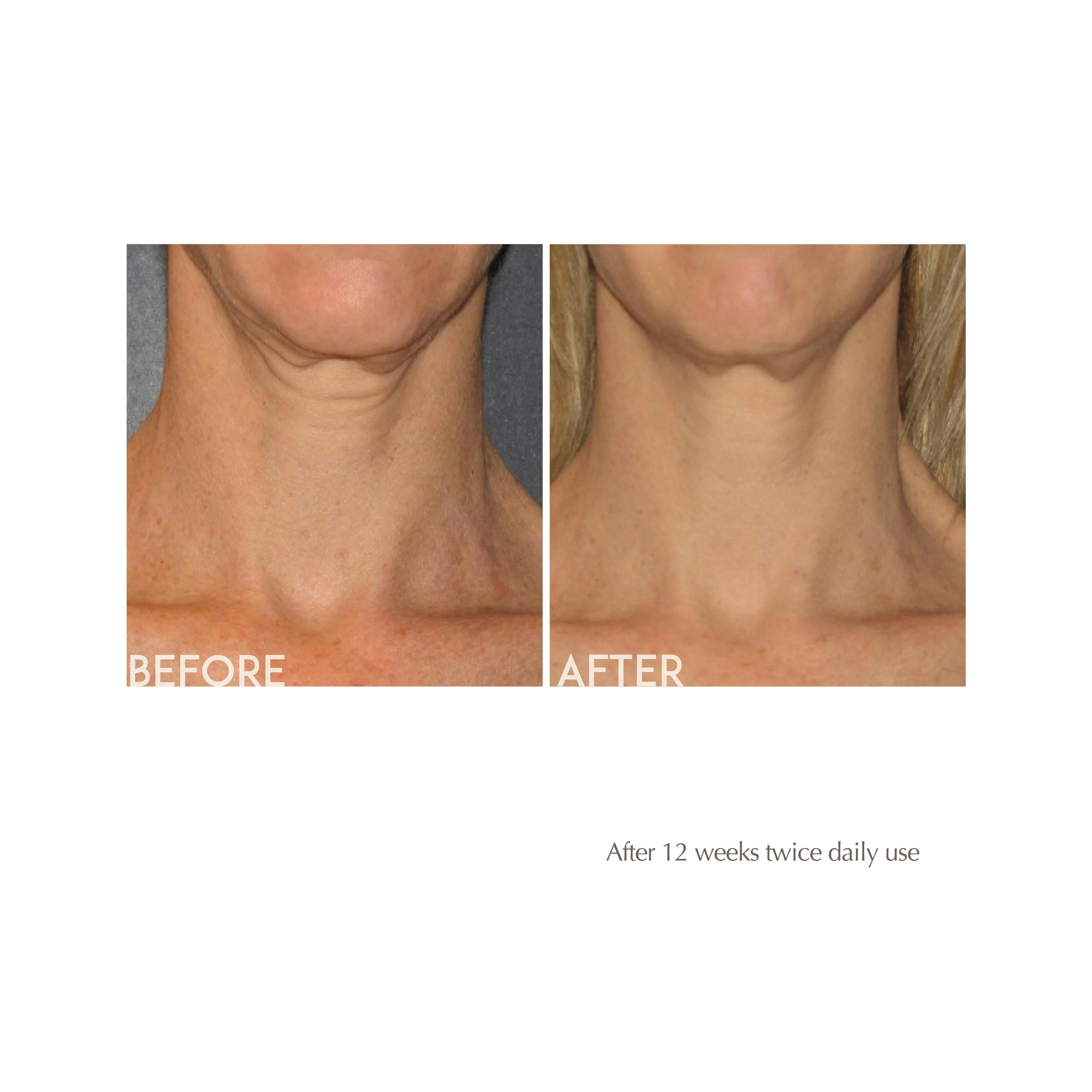 AGE REVERSE Toning Neck Cream - Image 4