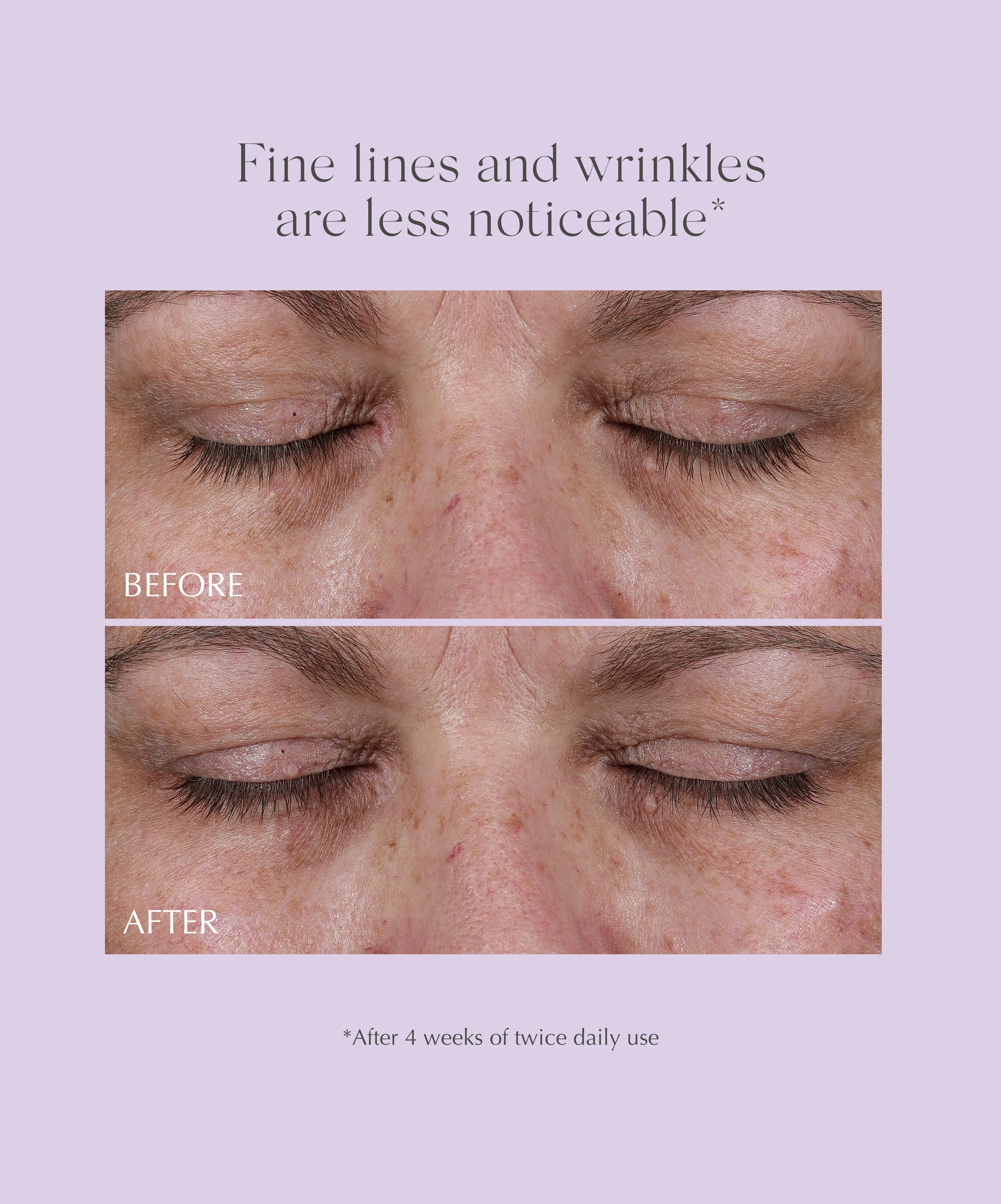 AGE REVERSE+ Total 360 Eye Contour - Image 7