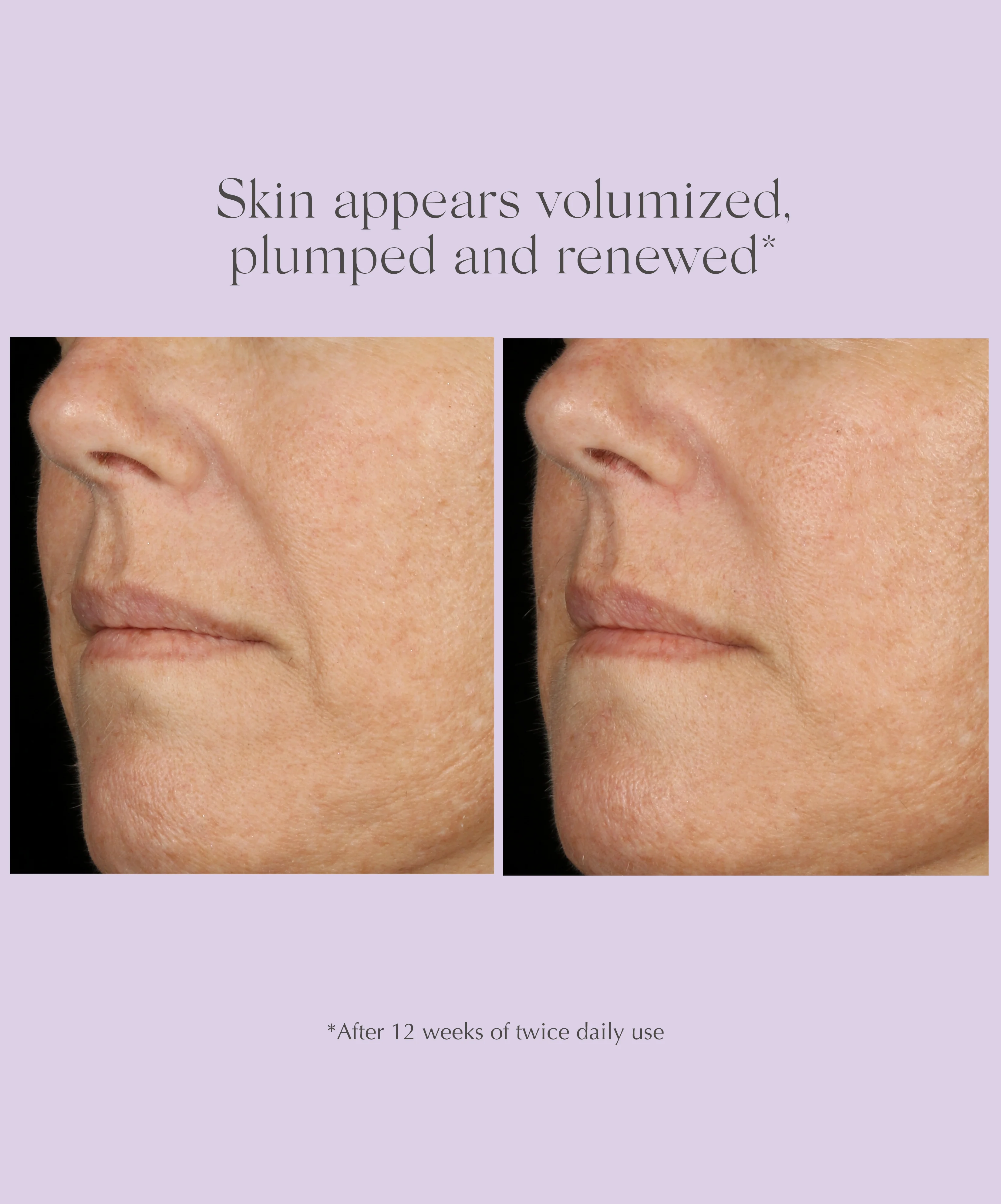 AGE REVERSE+ Total Correct Serum - Image 7