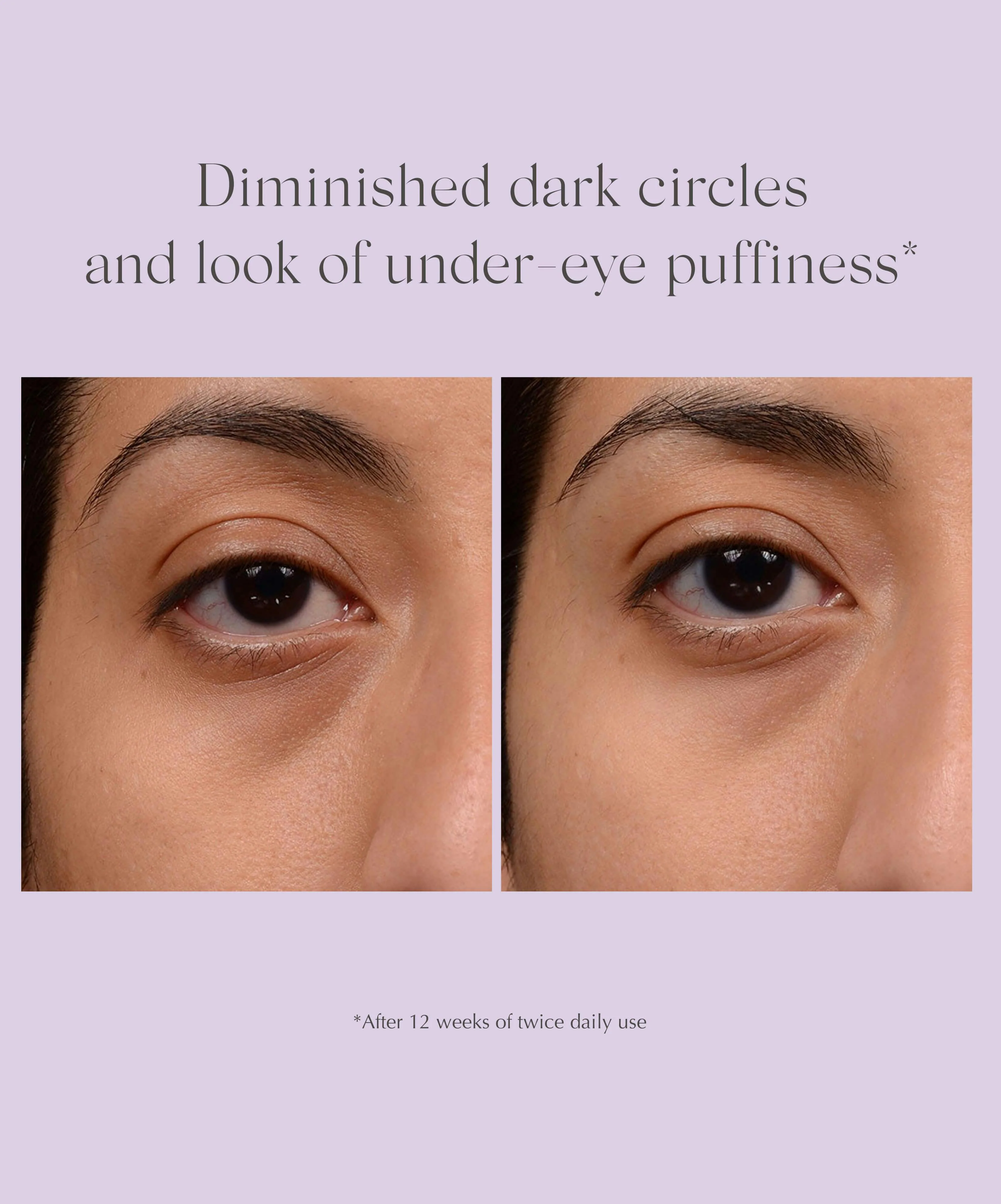 Bright Eyes Dark Circle Corrector - Image 3