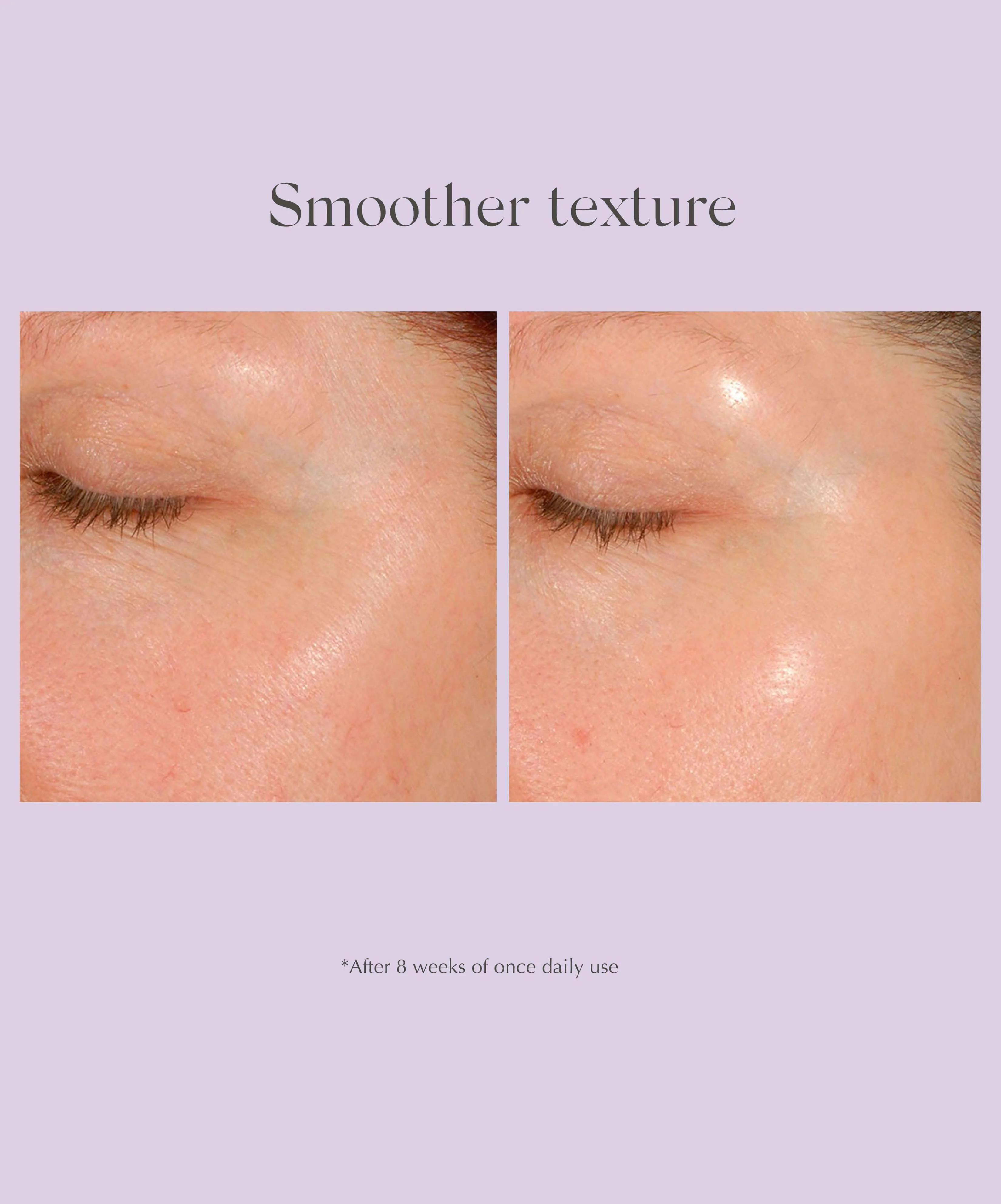 Daily Resurfacing Peel CA¹⁰ - Image 4