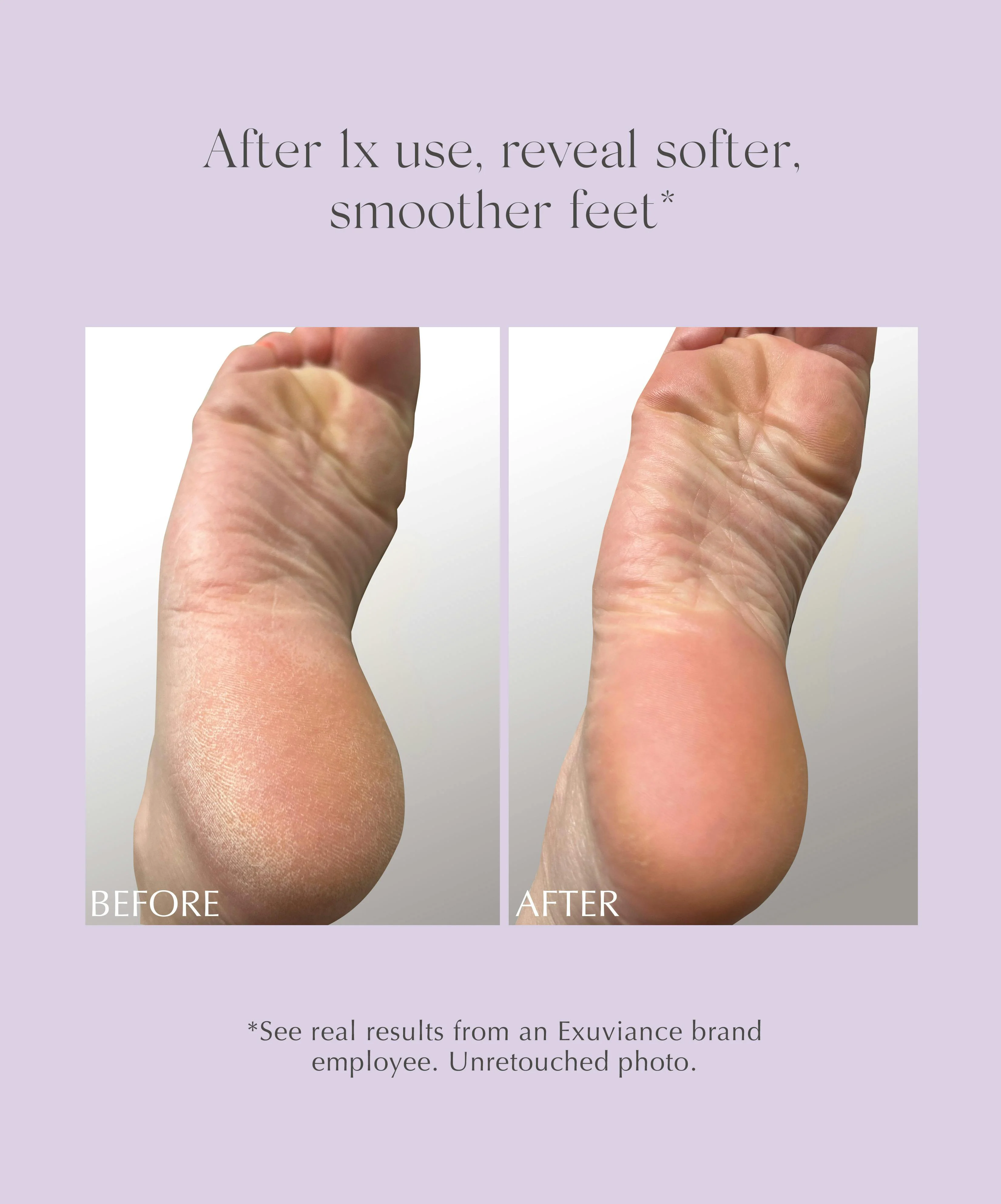 Exfoliating & Conditioning Foot Balm - Image 5