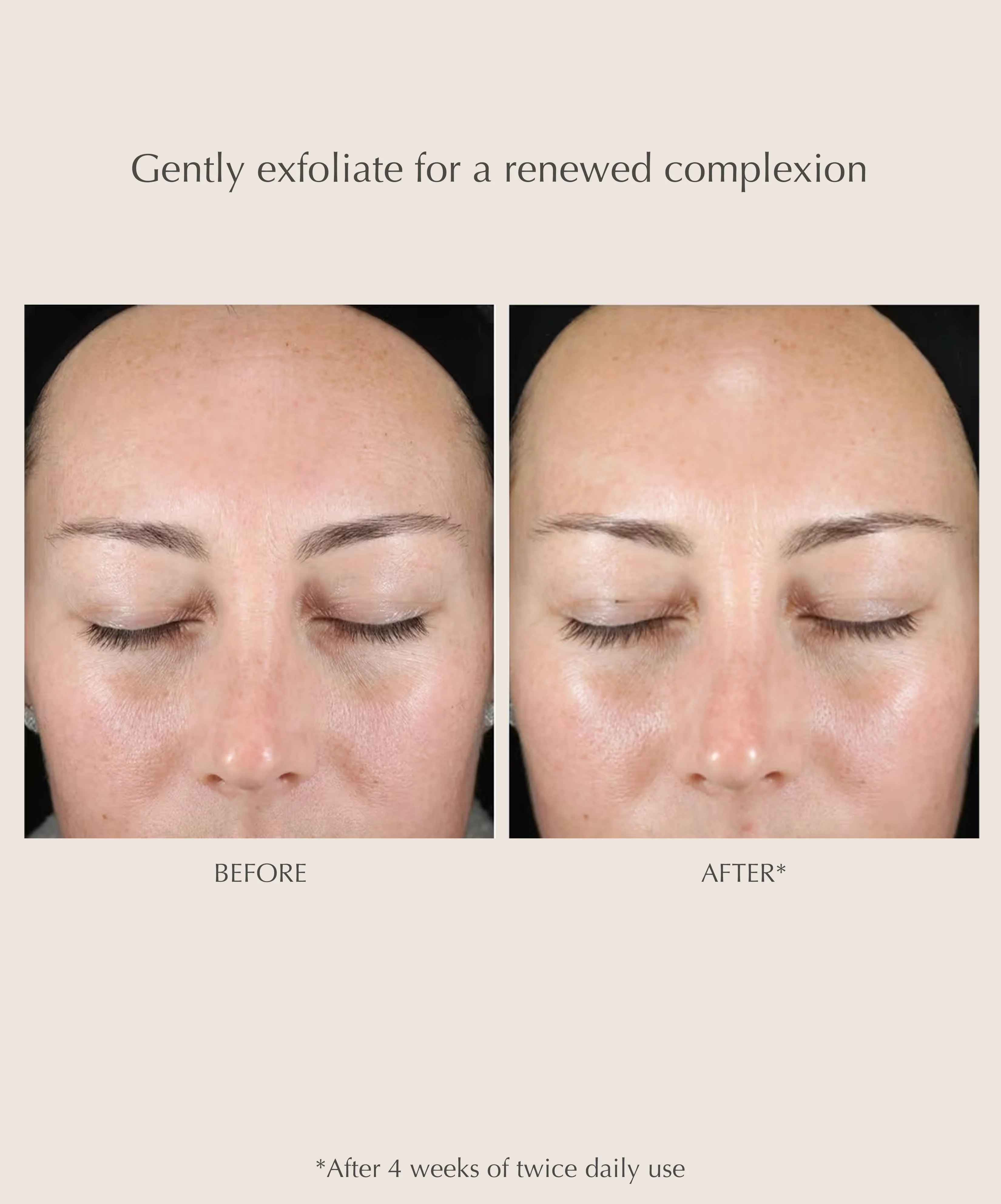 Gentle Daily Exfoliating Pads - Image 5