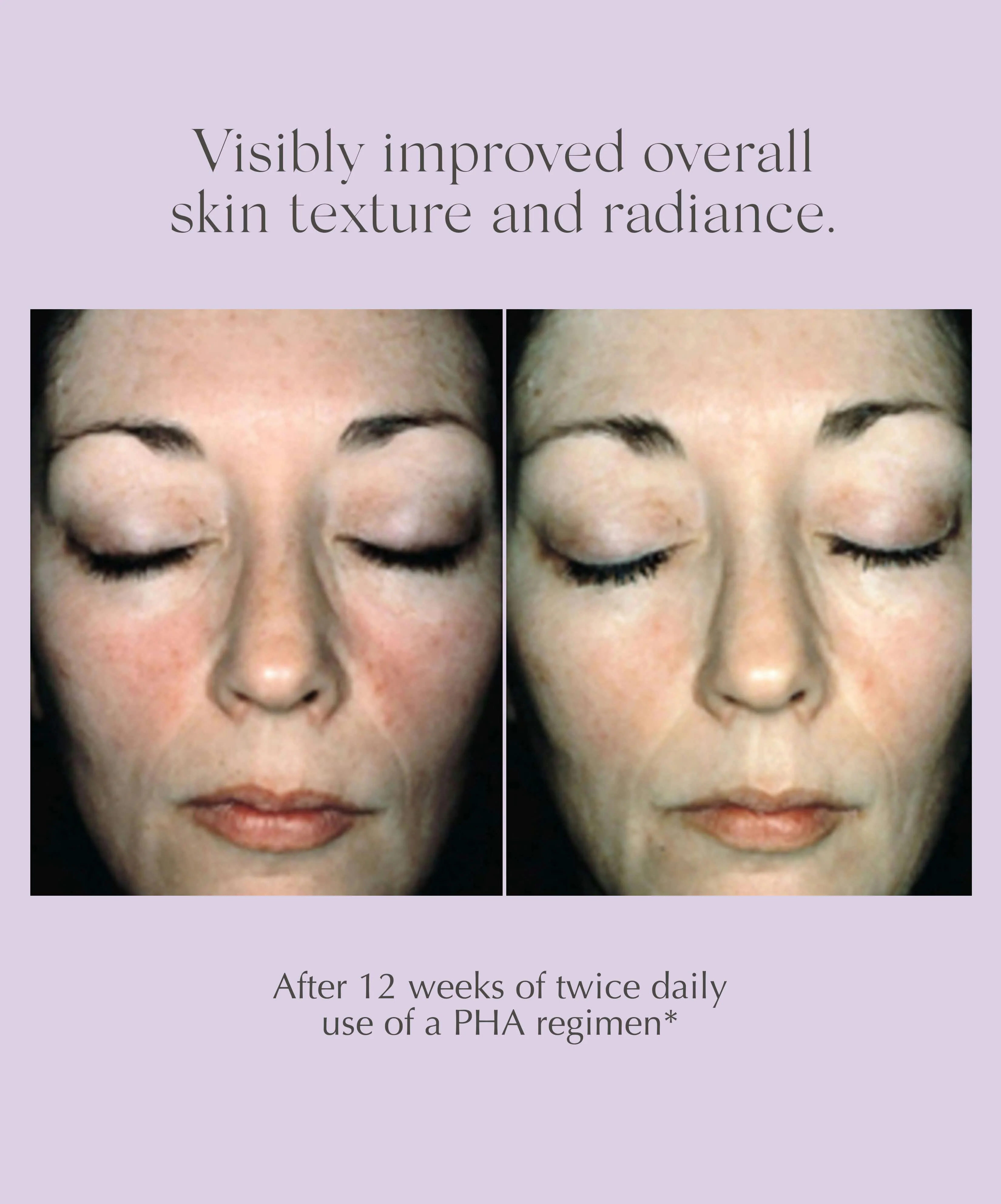 Overnight Transformation Complex - Image 4