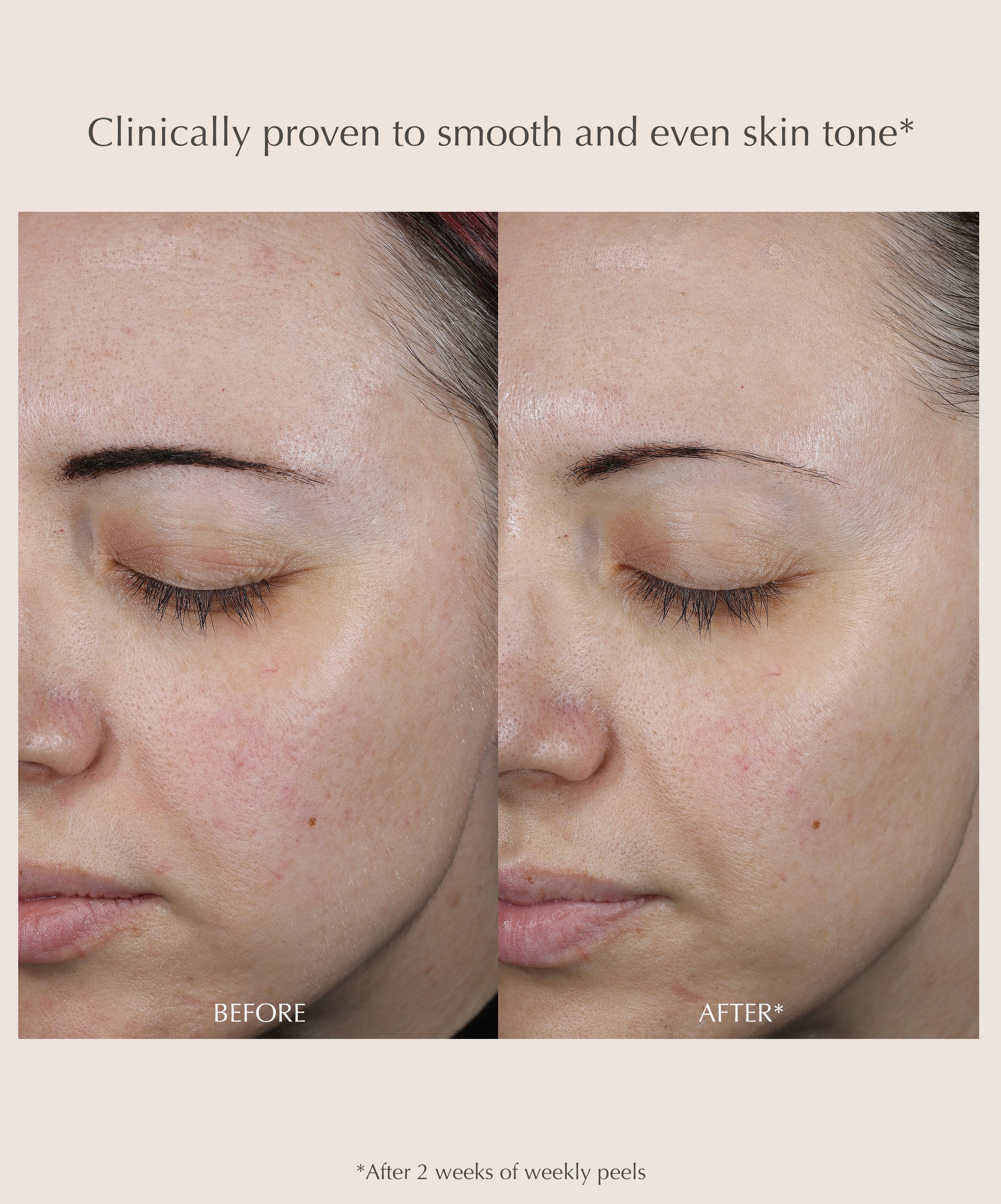 Performance Peel AP25 At-Home Chemical Peel - Image 6