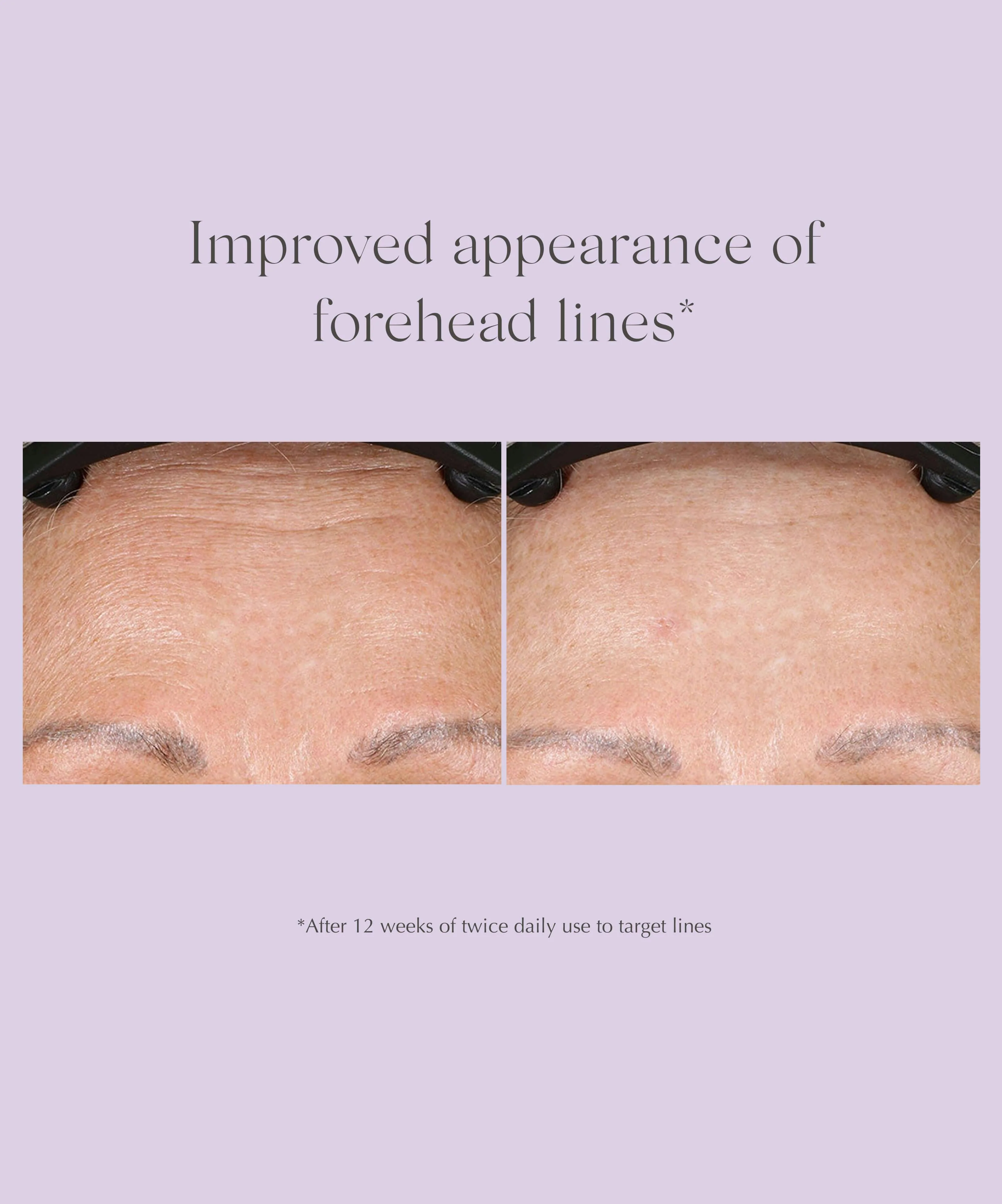 Wrinkle Smooth Topical Peptide - Image 4